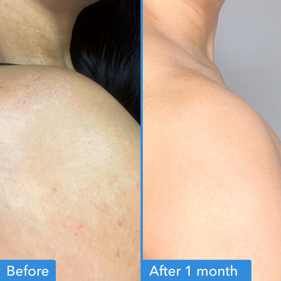 Good Molecules Discoloration Correcting Body Treatment 120ml (2-Pack) alternative view 3.
